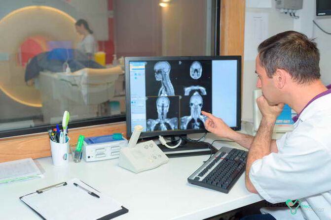 Computerdiagnose einer thorakalen Osteochondrose